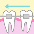 矯正治療はなぜ歯が動くのか？